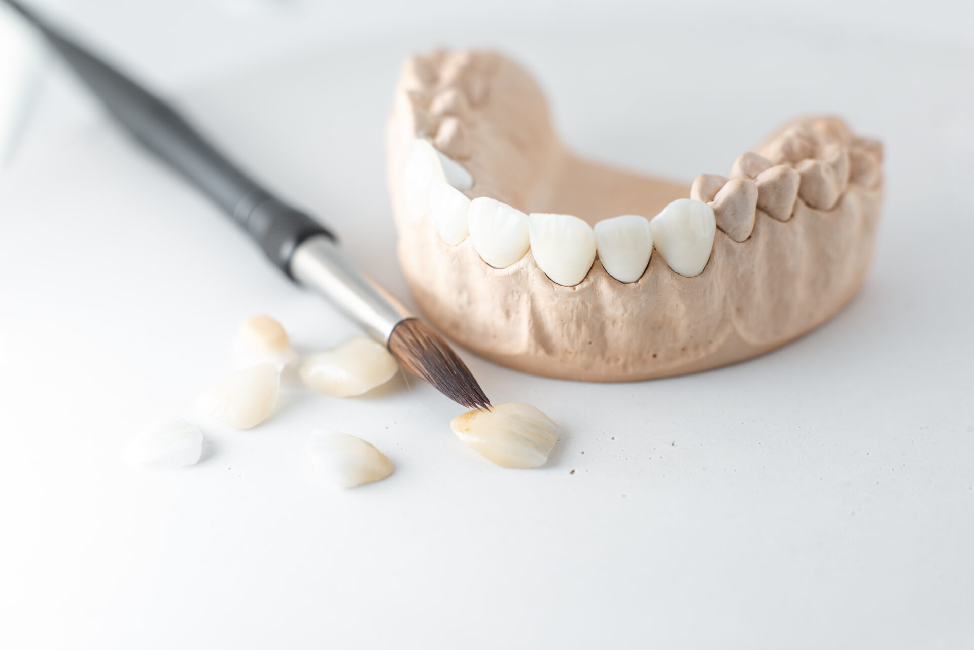 Plaster model of teeth beside thin ceramic veneers and a fine brush