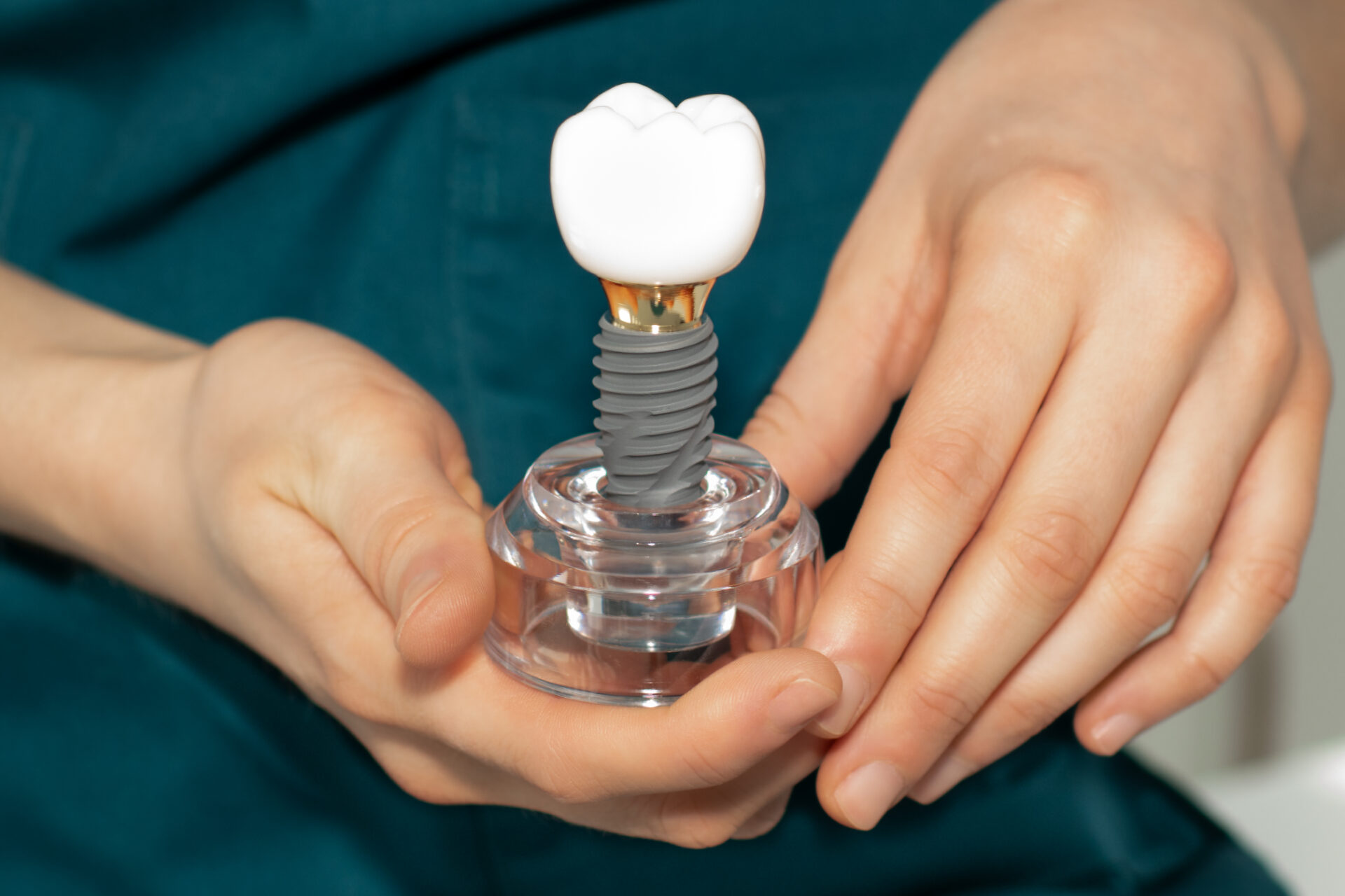 Hands holding a model of a dental implant with a crown on top